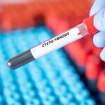 “Life Change” treatment that is now available for cystic fibrosis patients